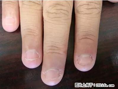 剪指甲、挖耳屎，这些日常小动作竟隐藏大危害！ - 楚雄生活资讯 - 楚雄28生活网 cx.28life.net
